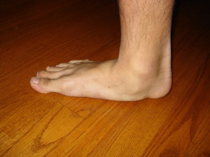 flatfoot2
